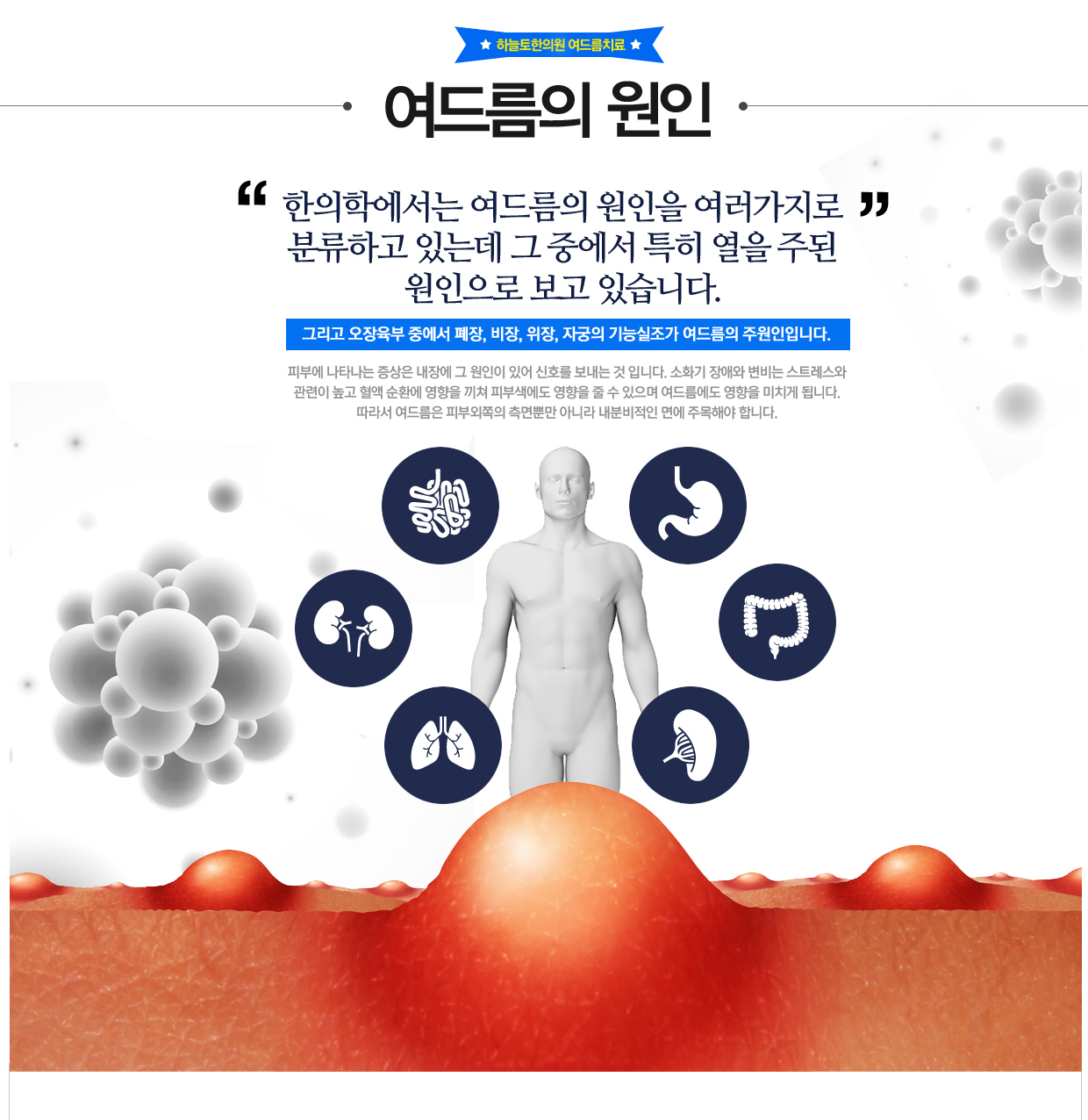 여드름의원인