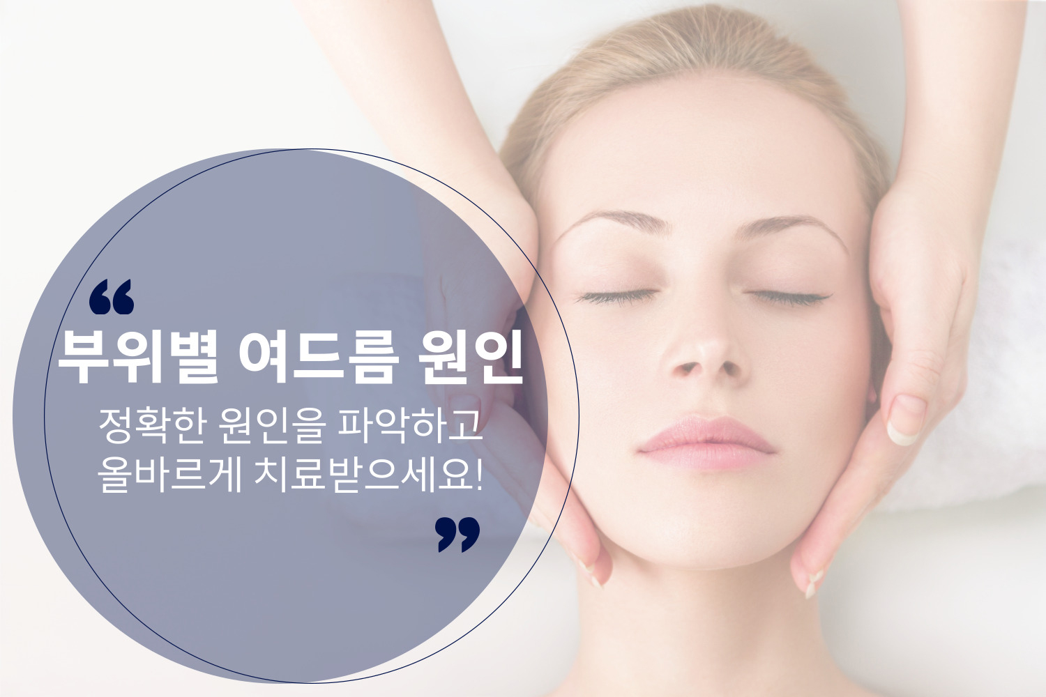 부위별여드름