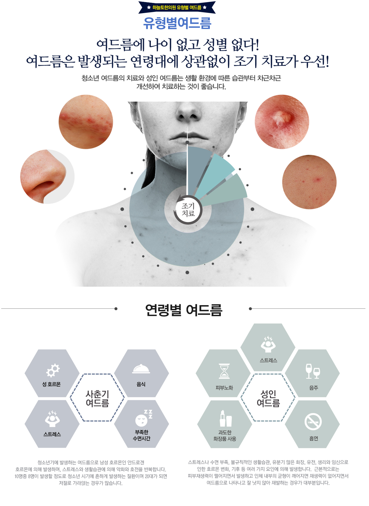 유형별여드름