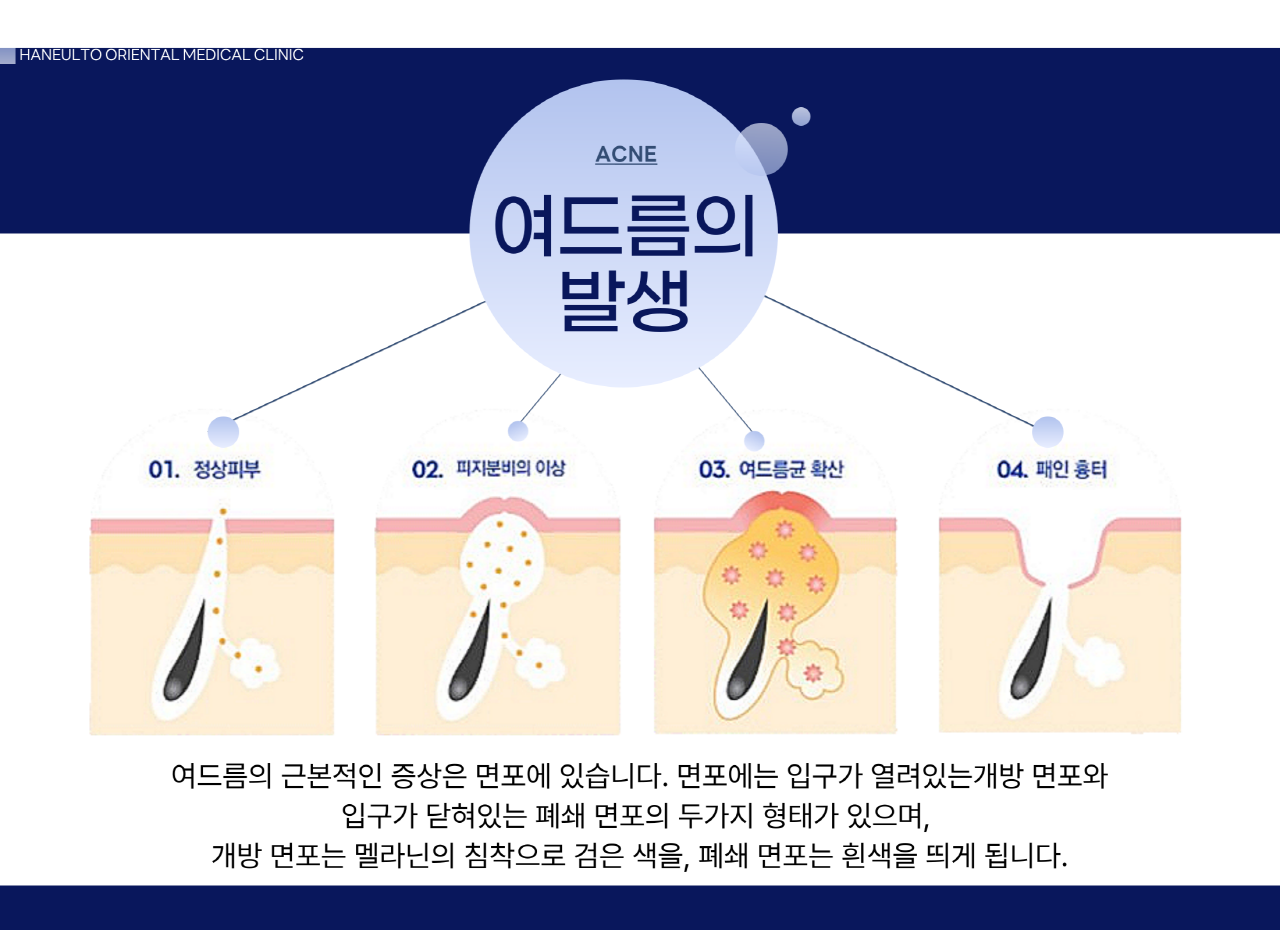 치료후관리