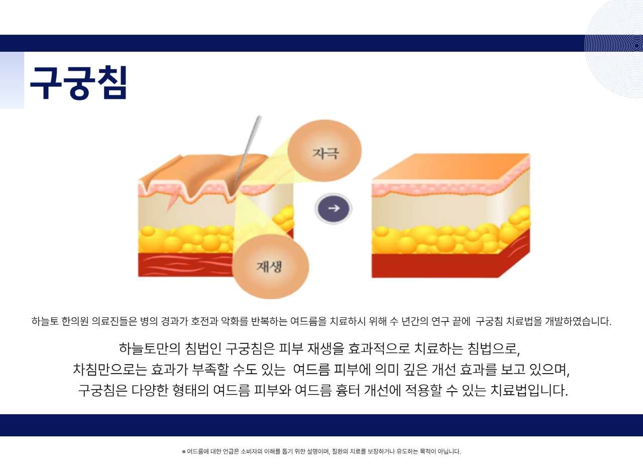 치료후관리