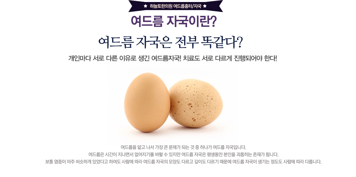 여드름자국의 원인