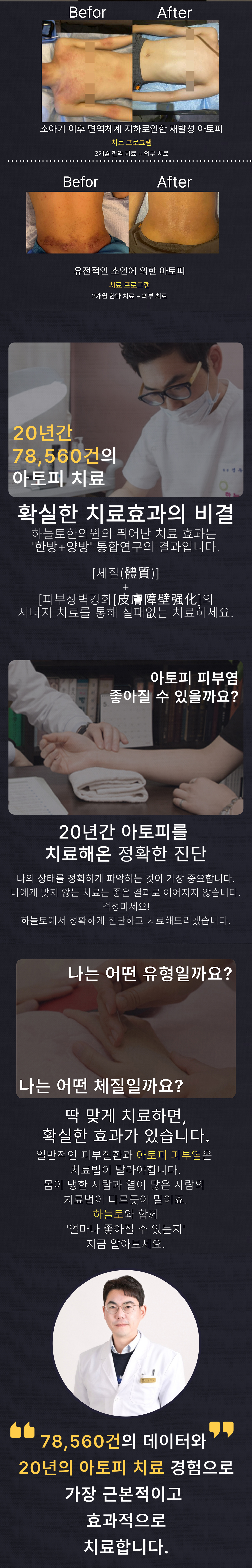 아토피의 원인