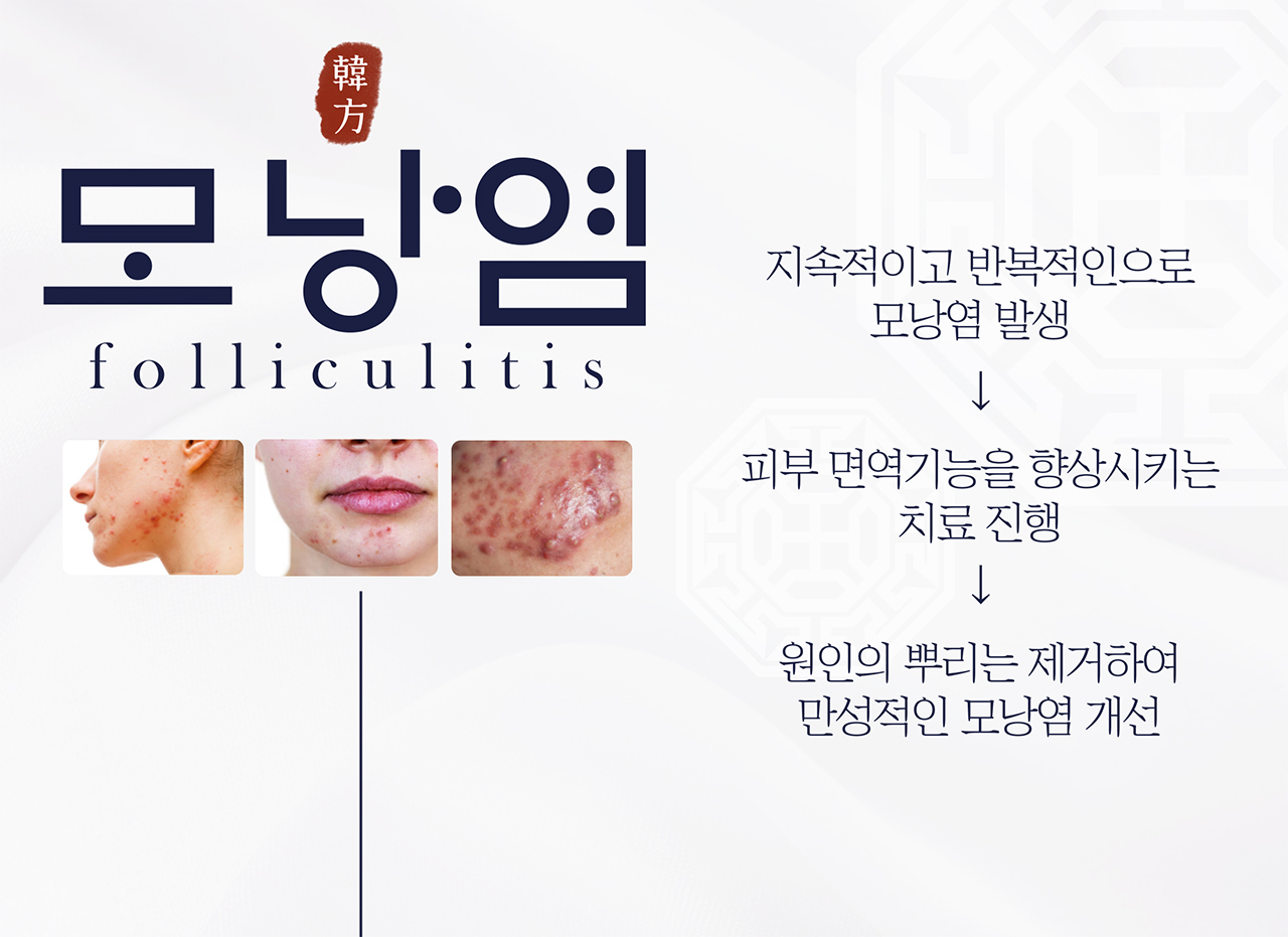 치료프로그램