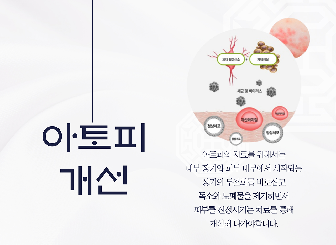 치료프로그램