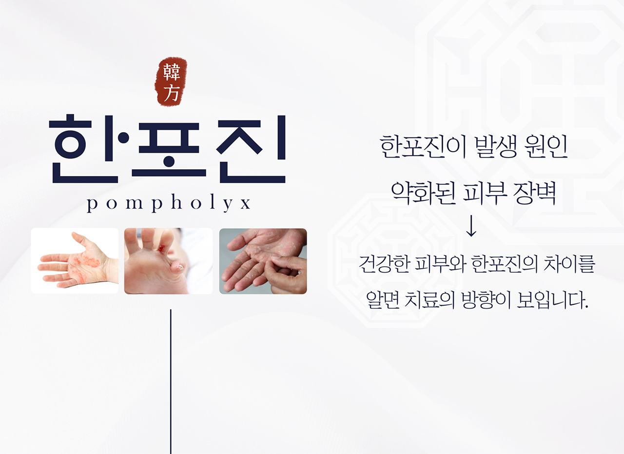 치료프로그램