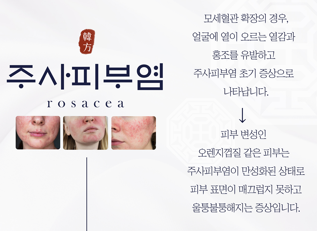 치료프로그램