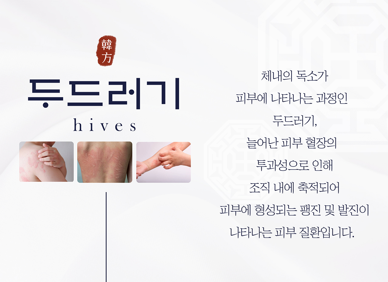치료프로그램