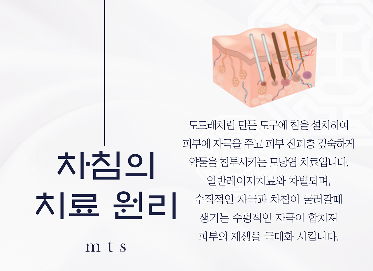 치료프로그램