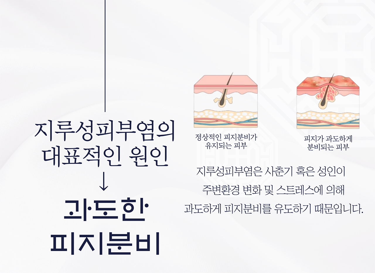 치료프로그램