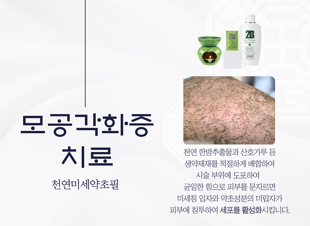 치료프로그램