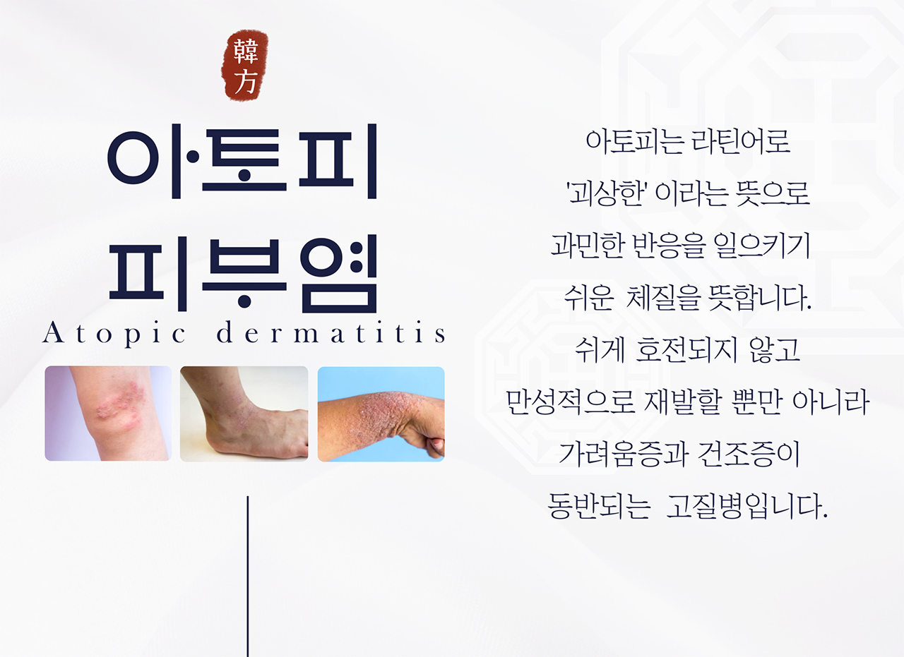 치료프로그램