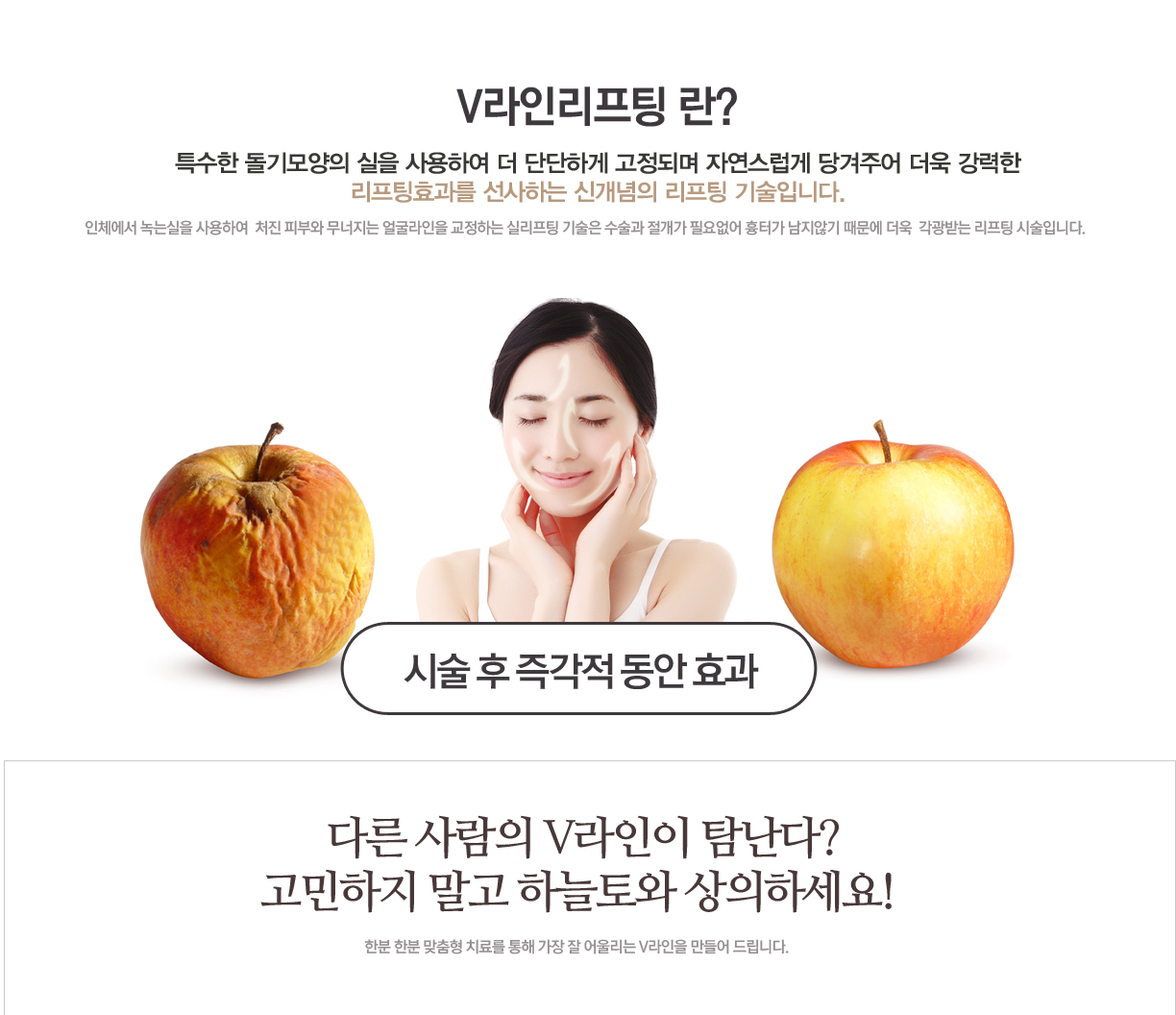 V라인리프팅